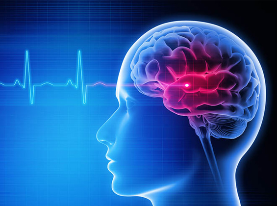 🧠🚨 Brain Stroke: Act Fast, Save Lives